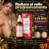 Cyperus Rotundus Oil™ - Elimina el Bello de Raíz